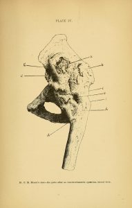 Diagram of damaged bone, perhaps a hip joint