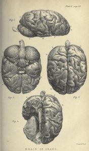Four views of a brain