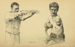 Illustration of man holding rifle and man with amputated arm