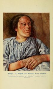 Full page color illustration of patient with skin condition