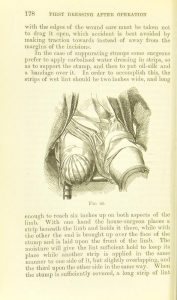 Half page black and white illustration of how to bandage a leg wound
